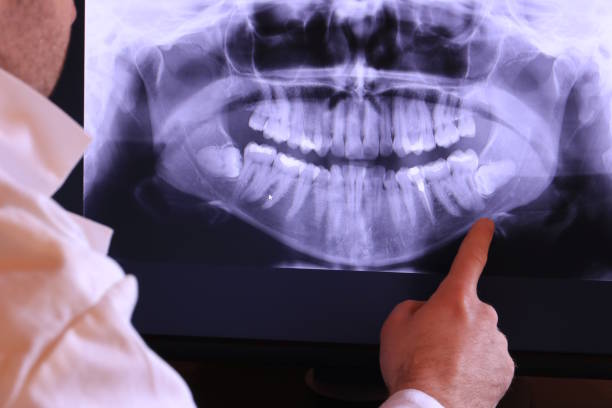 Best Urgent Tooth Repair  in Horse Shoe, NC