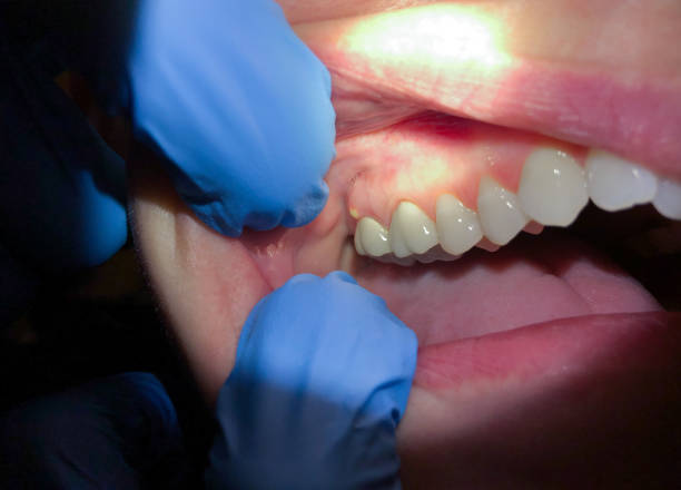 Best Emergency Dentist Near Me  in Horse Shoe, NC