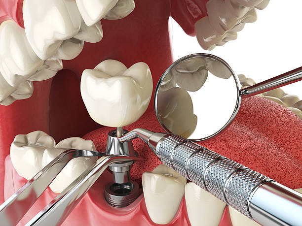 Best Cracked Tooth Emergency Dentist  in Horse Shoe, NC